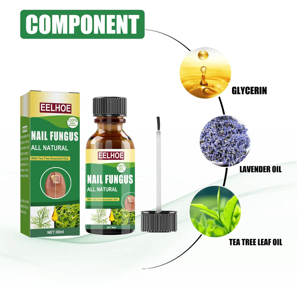 30ml bottle of thick tea tree oil nail care solution for hands and feet
