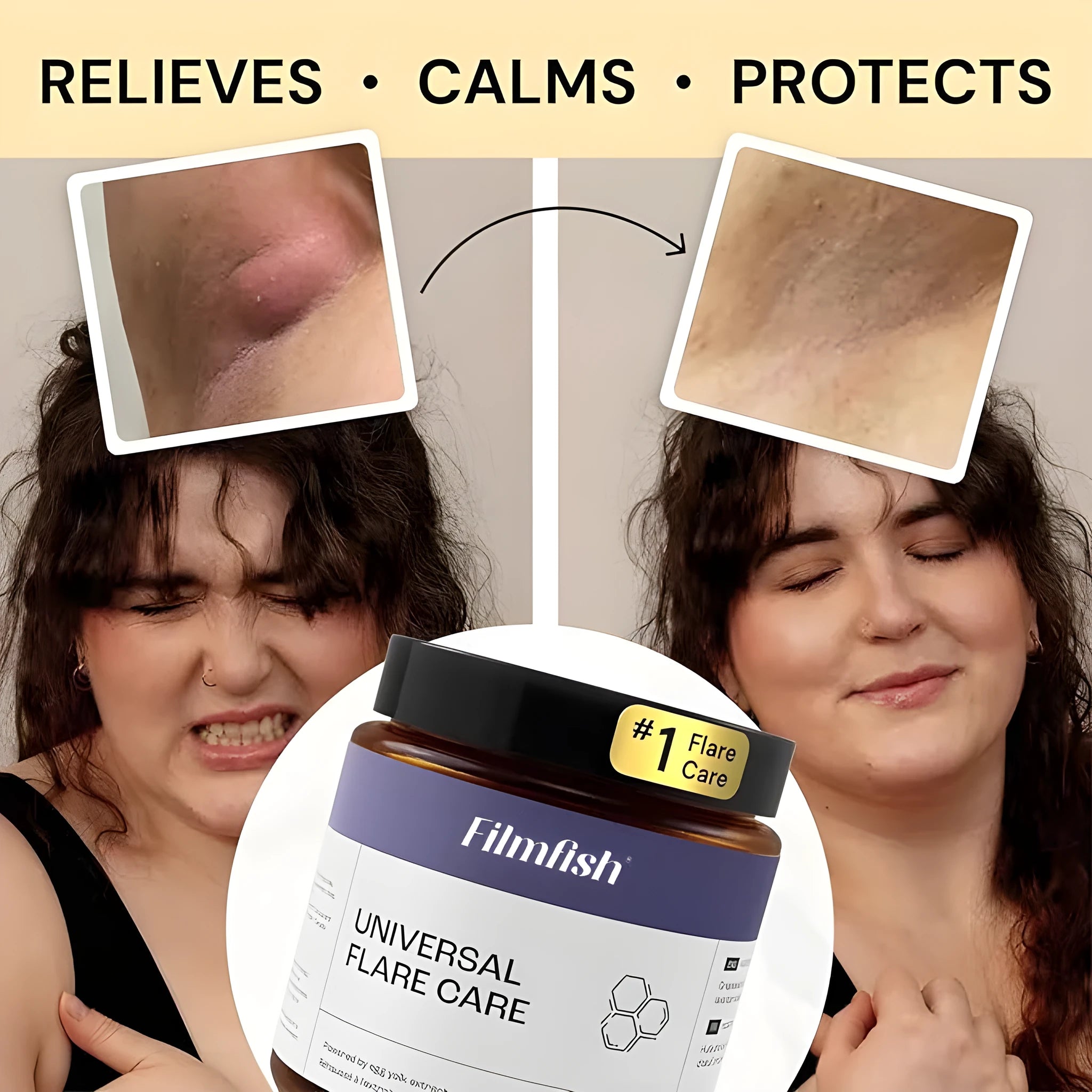 Keep Skin Calm Repair Factor Skin Care Body Repair Cream 141g Tea Tree variant pot packaging
