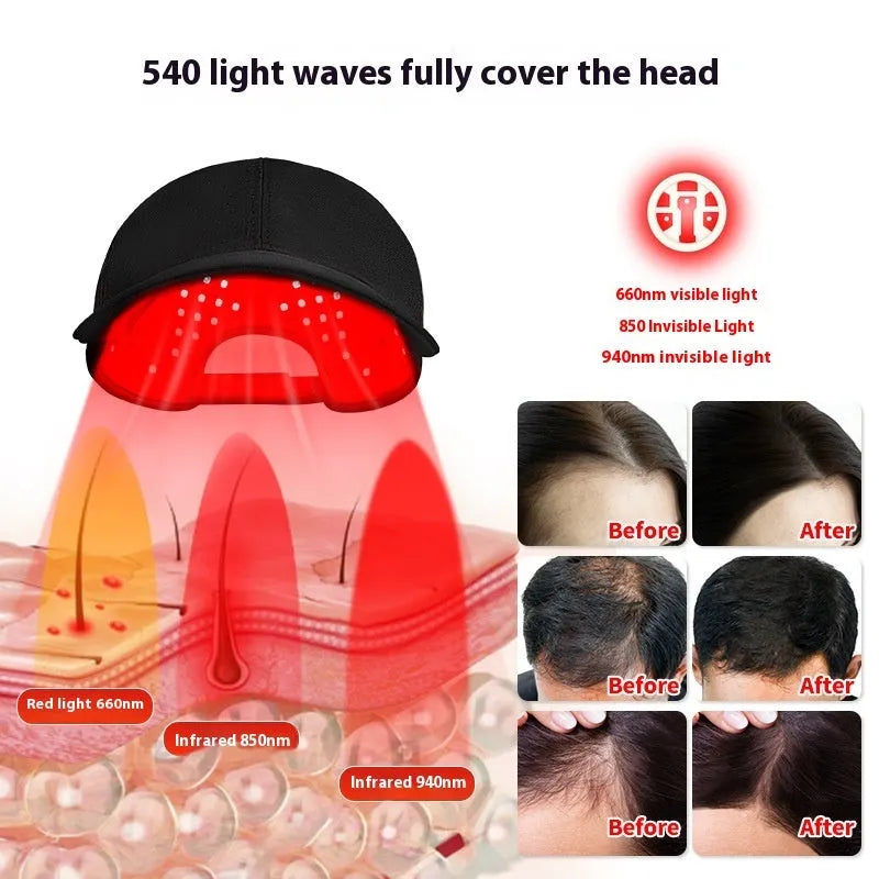 Black infrared duckbill hair growth cap with 180 LED lights and controller for scalp therapy