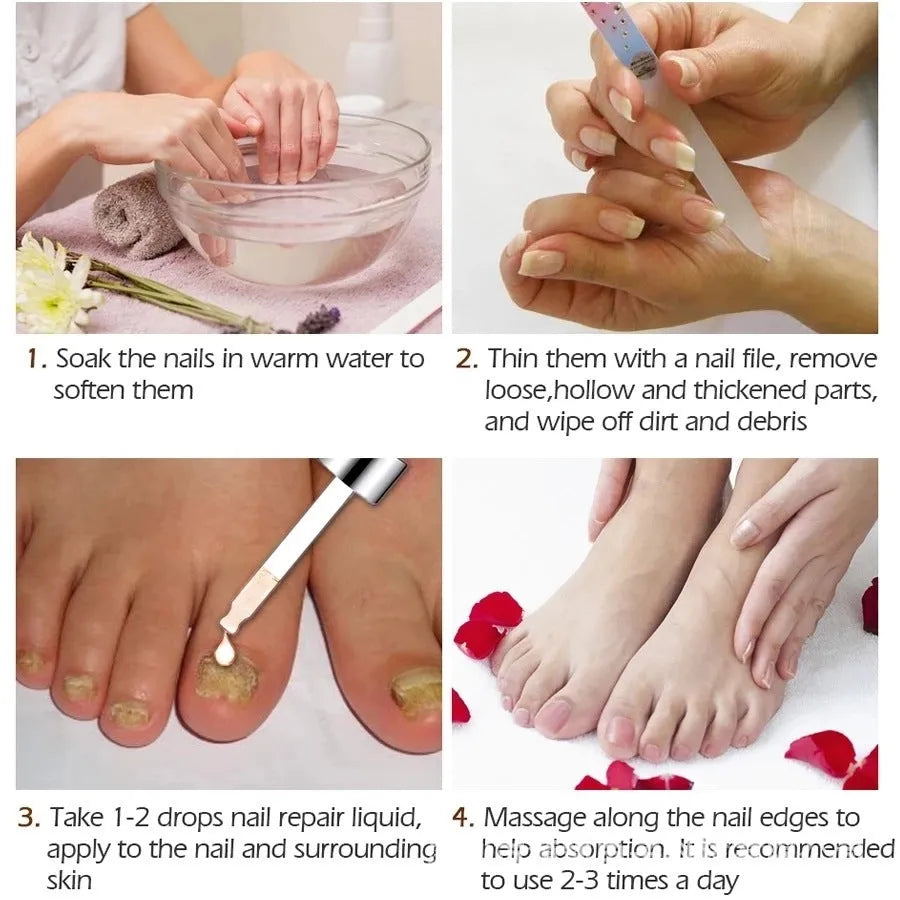 Whitenail Antibacterial Liquid 10ml bottle for foot care and deck repair dust treatment