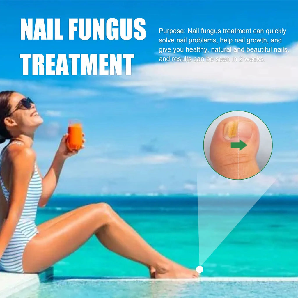 30ml bottle of thick tea tree oil nail care solution for hands and feet