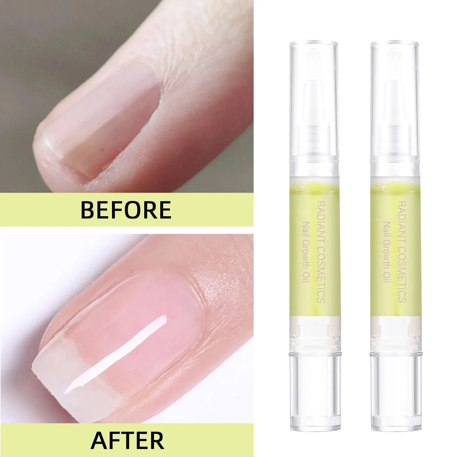 3ml bottle of nail growth treatment oil with wash-free formula for nail care
