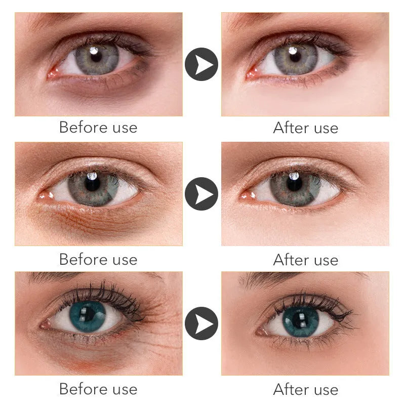 30ml eye cream container for women's under-eye skincare treatment