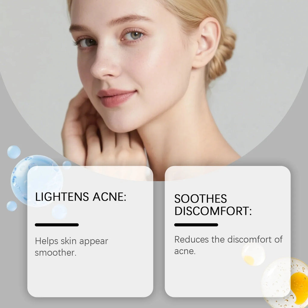80 hydrocolloid acne patches in round shapes for facial spot treatment