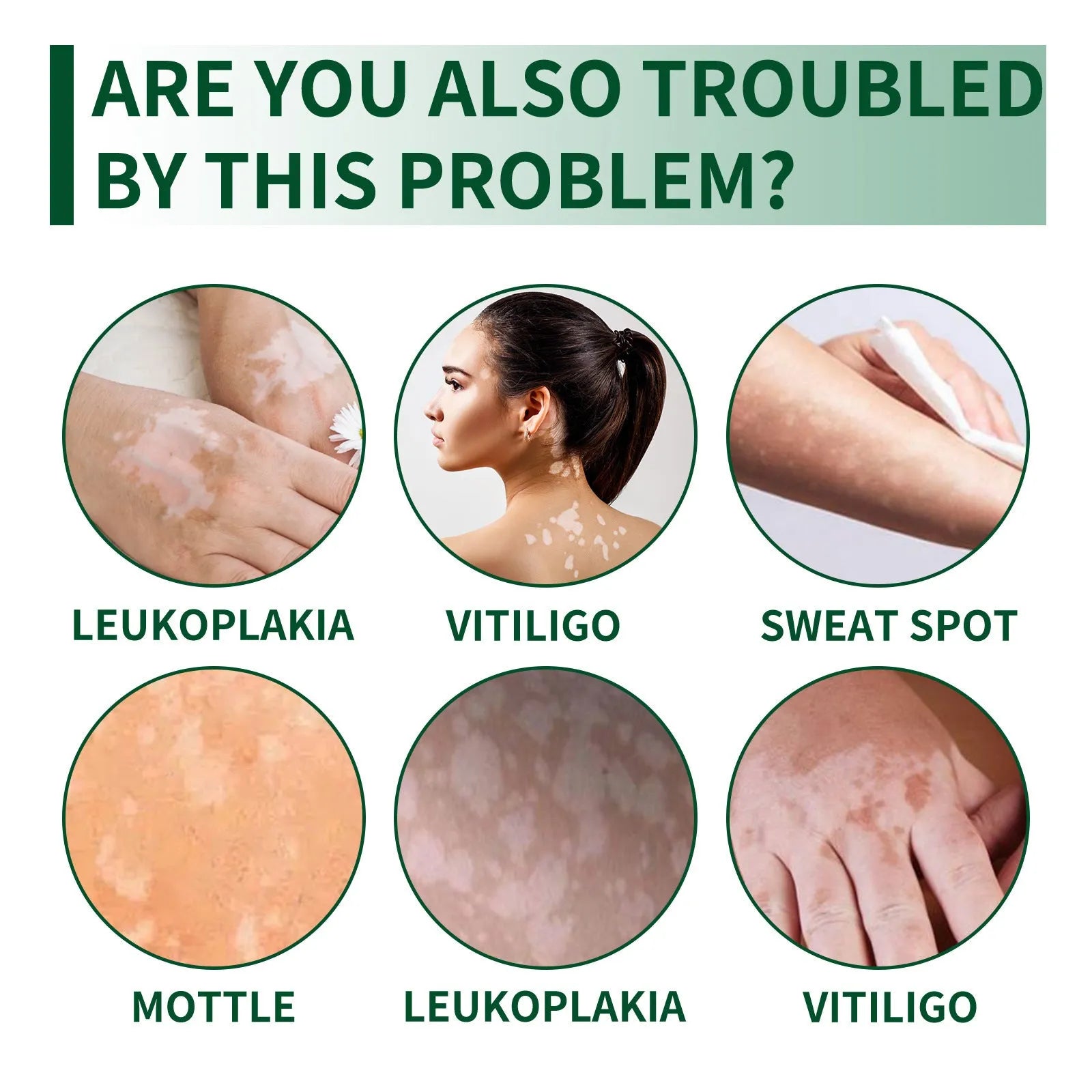 35g tube of body care cream for skin cleansing and moisturising to address orange peel tissue