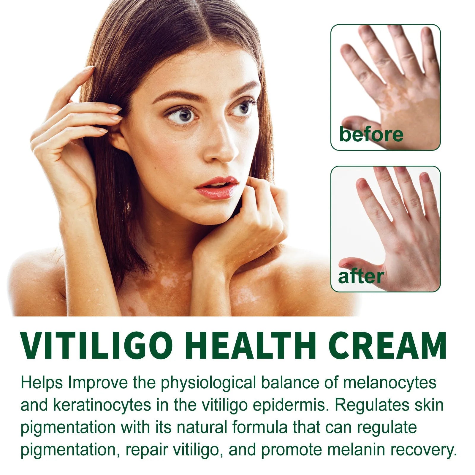 35g tube of body care cream for skin cleansing and moisturising to address orange peel tissue
