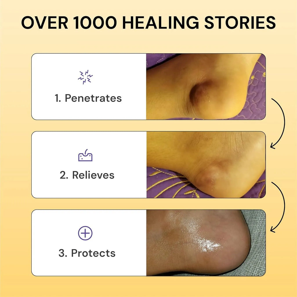 120g tube of Universal Flare Care muscle and joint pain relief cream with no logo branding