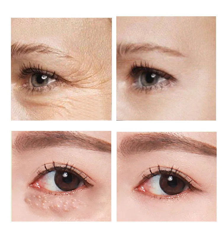 30ml eye cream container for women's under-eye skincare treatment